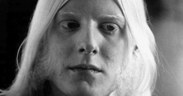 Image in QuizMyDay Edgar Winter Quiz: Test Your Music Expertise trivia quiz featuring Photo of musician Edgar Winter.